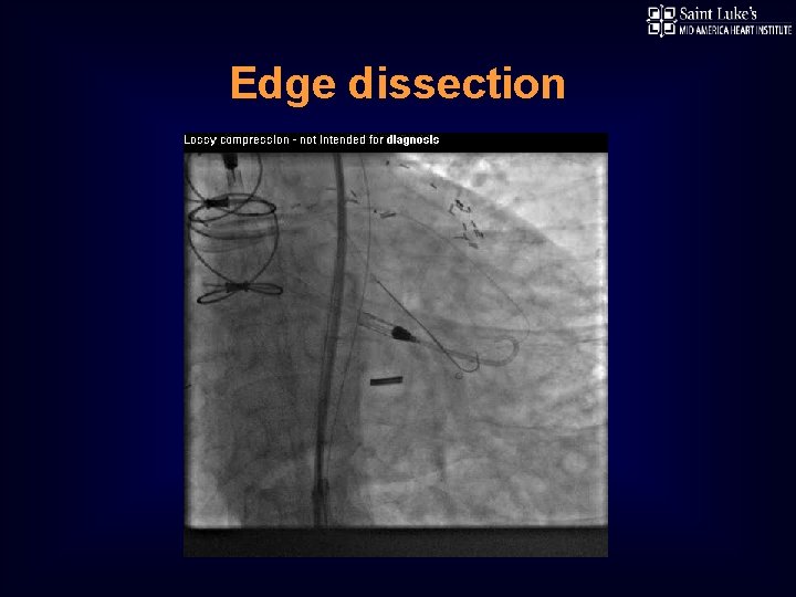 Edge dissection 
