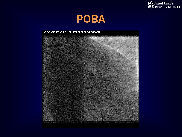 POBA 