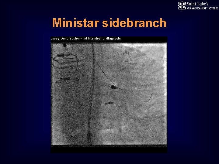 Ministar sidebranch 