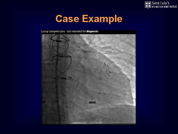 Case Example 