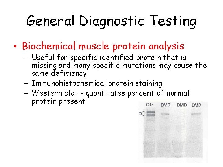 General Diagnostic Testing • Biochemical muscle protein analysis – Useful for specific identified protein