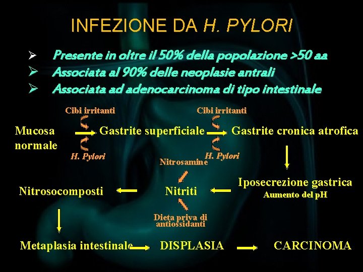 INFEZIONE DA H. PYLORI Presente in oltre il 50% della popolazione >50 aa Ø