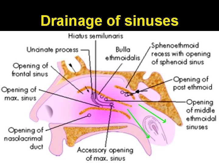Drainage of sinuses 