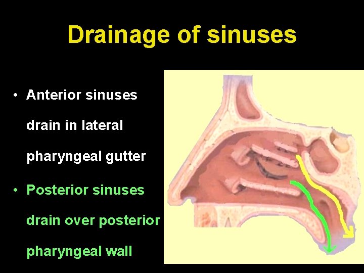 Drainage of sinuses • Anterior sinuses drain in lateral pharyngeal gutter • Posterior sinuses