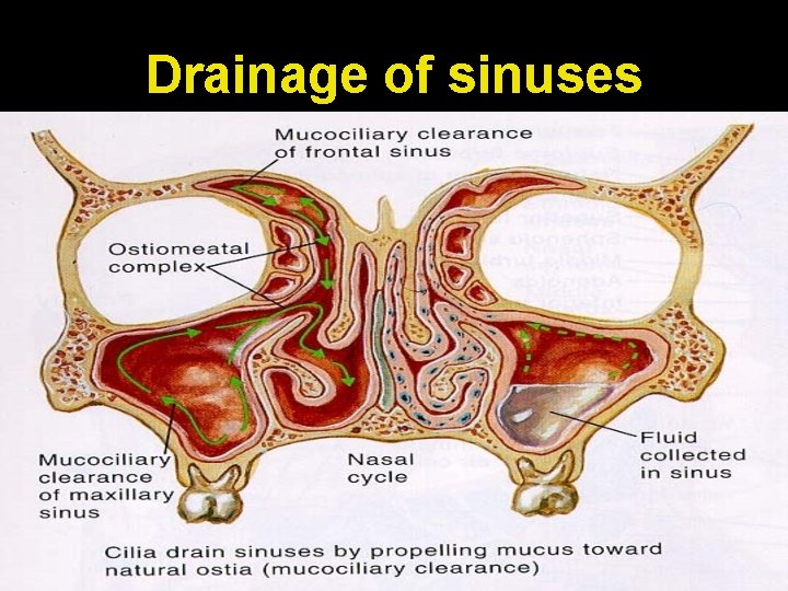 Drainage of sinuses 