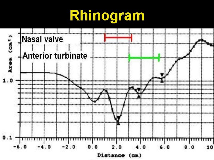 Rhinogram 