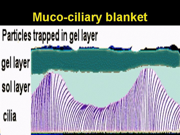 Muco-ciliary blanket 