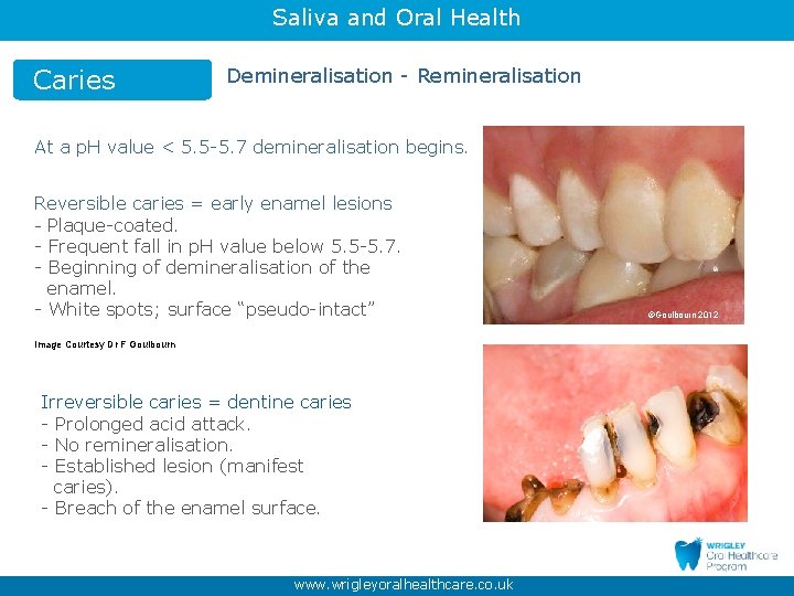 Saliva and Oral Health Caries Demineralisation - Remineralisation At a p. H value <