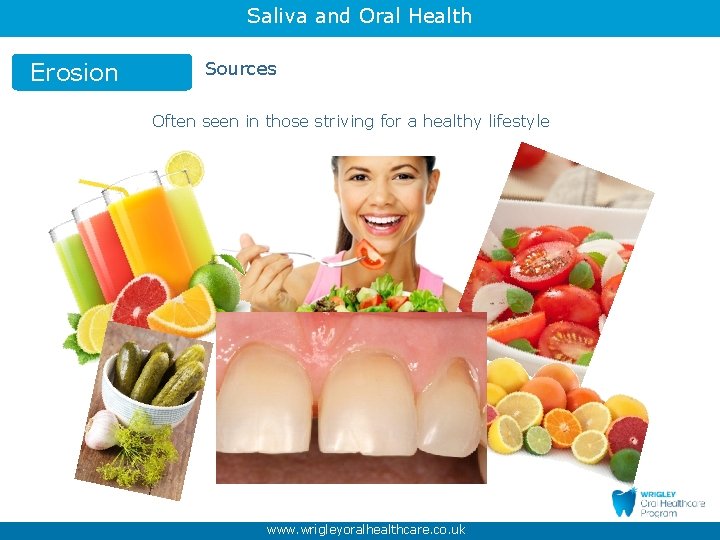 Saliva and Oral Health Erosion Sources Often seen in those striving for a healthy