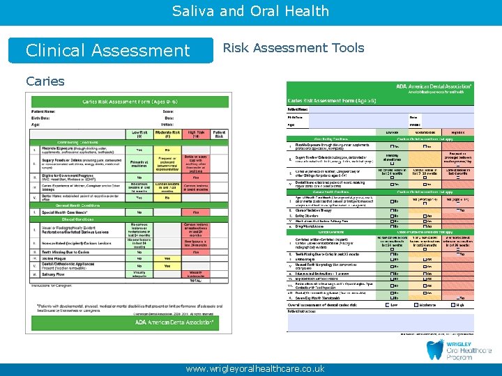 Saliva and Oral Health Clinical Assessment Risk Assessment Tools Caries www. wrigleyoralhealthcare. co. uk