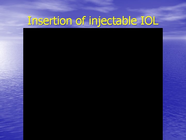 Insertion of injectable IOL 