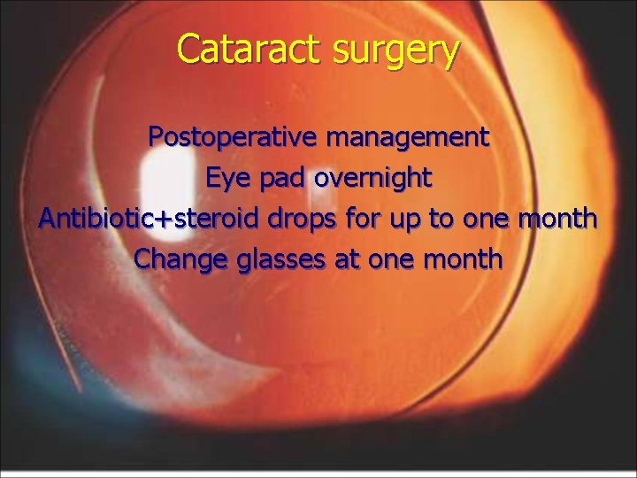 Cataract surgery Postoperative management Eye pad overnight Antibiotic+steroid drops for up to one month