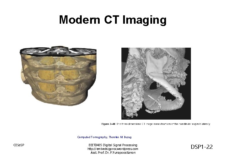 Modern CT Imaging Computed Tomography, Thorsten M. Buzug CESd. SP EEET 0485 Digital Signal Modern CT Imaging Computed Tomography, Thorsten M. Buzug CESd. SP EEET 0485 Digital Signal