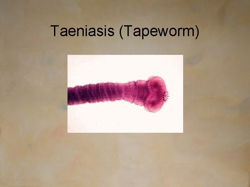 Taeniasis (Tapeworm) 