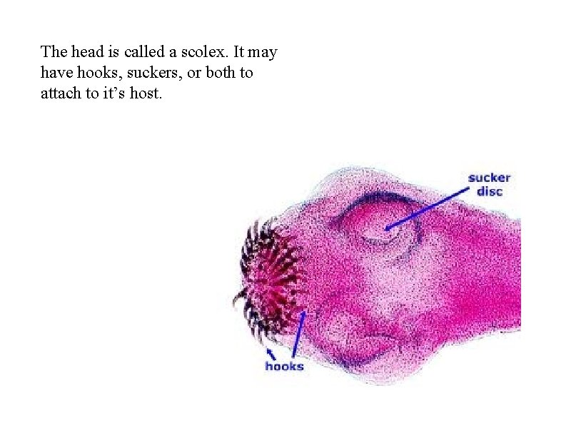 The head is called a scolex. It may have hooks, suckers, or both to