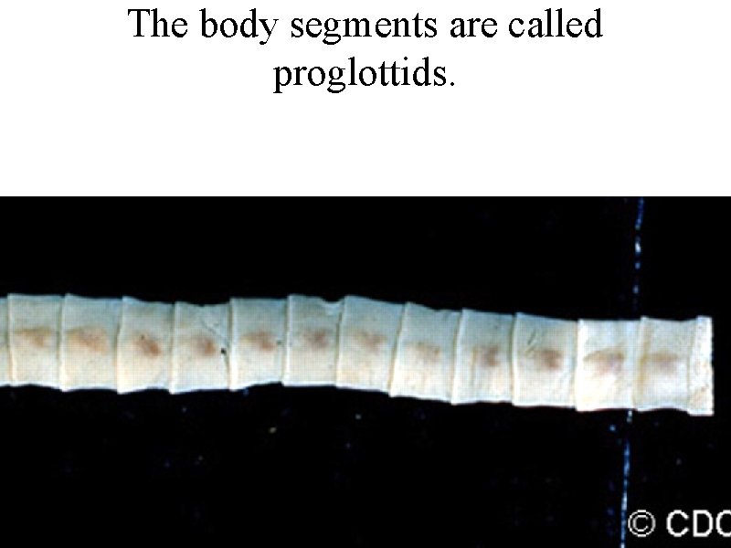 The body segments are called proglottids. 