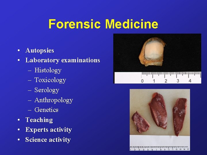 Forensic Medicine • Autopsies • Laboratory examinations – Histology – Toxicology – Serology –