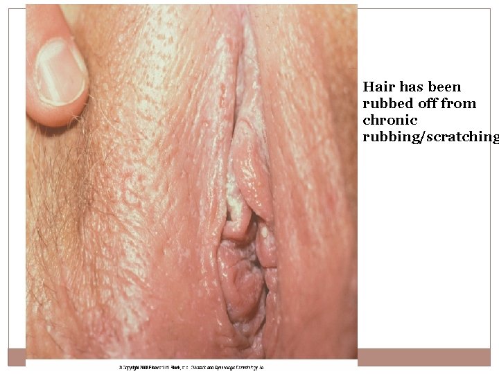 Hair has been rubbed off from chronic rubbing/scratching 