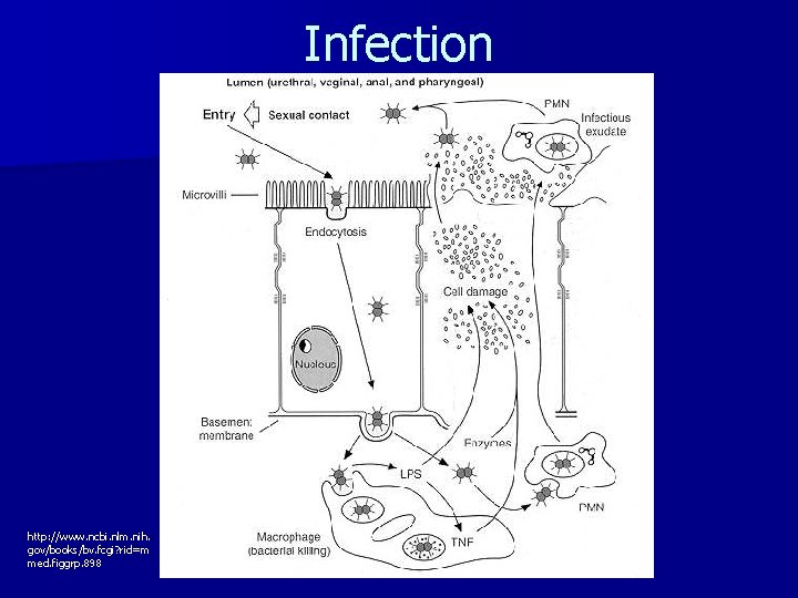 Infection http: //www. ncbi. nlm. nih. gov/books/bv. fcgi? rid=m med. figgrp. 898 