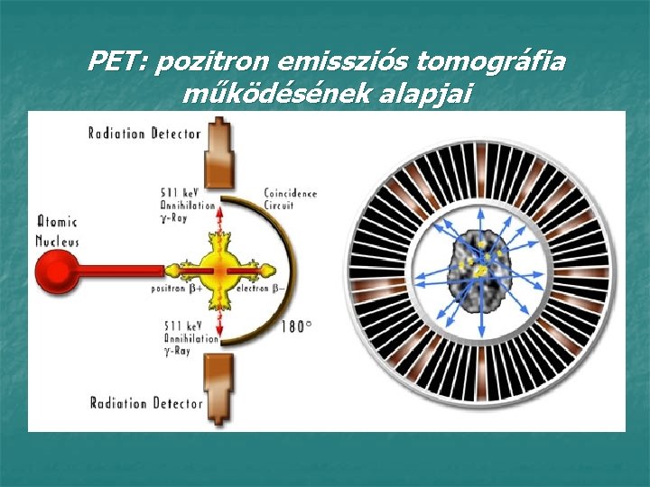 PET: pozitron emissziós tomográfia működésének alapjai 