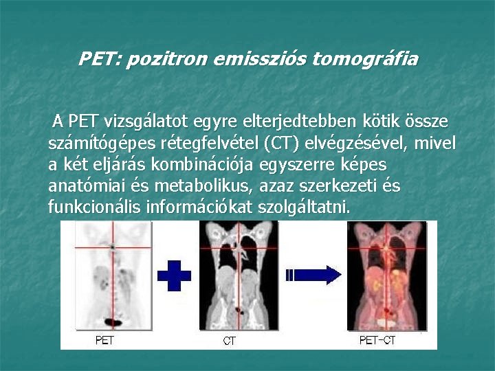 PET: pozitron emissziós tomográfia A PET vizsgálatot egyre elterjedtebben kötik össze számítógépes rétegfelvétel (CT)