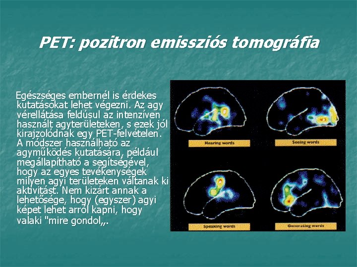 PET: pozitron emissziós tomográfia Egészséges embernél is érdekes kutatásokat lehet végezni. Az agy vérellátása