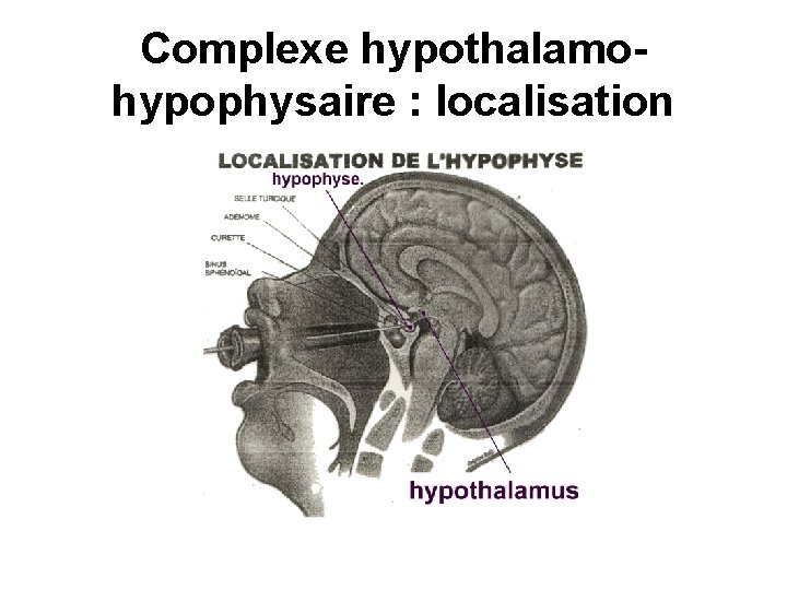 Complexe hypothalamohypophysaire : localisation 