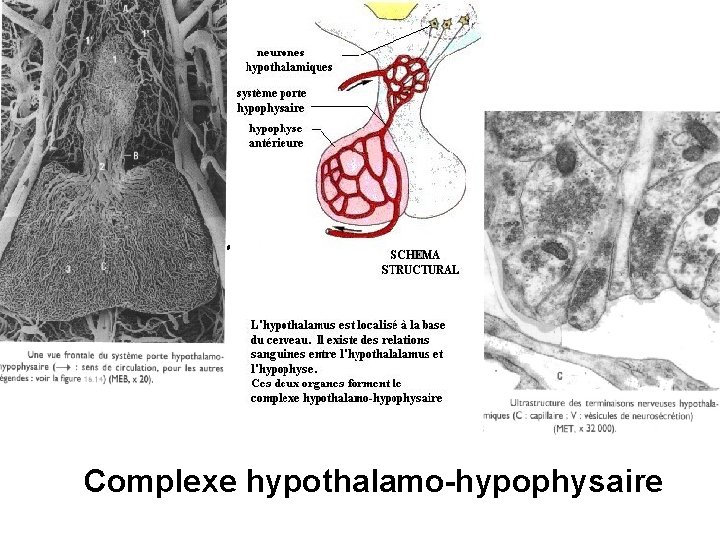 Complexe hypothalamohypophysaire Complexe hypothalamo-hypophysaire 