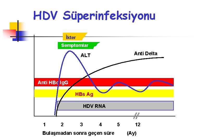 HDV Süperinfeksiyonu İkter Semptomlar Anti Delta ALT Anti HBc Ig. G HBs Ag HDV