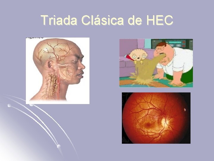 Triada Clásica de HEC 