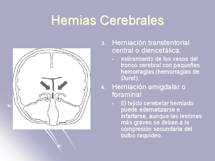 Hernias Cerebrales 3. Herniación transtentorial central o diencefálica. • 4. estiramiento de los vasos