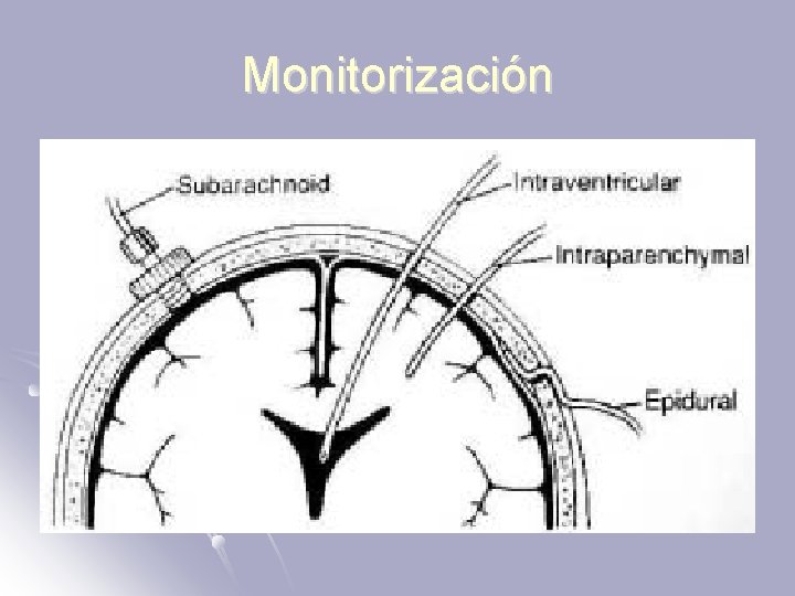 Monitorización 