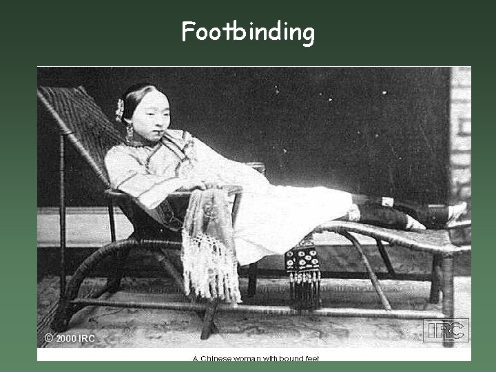 Footbinding 