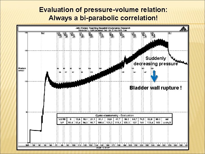 Evaluation of pressure-volume relation: Always a bi-parabolic correlation! Suddenly decreasing pressure Bladder wall rupture