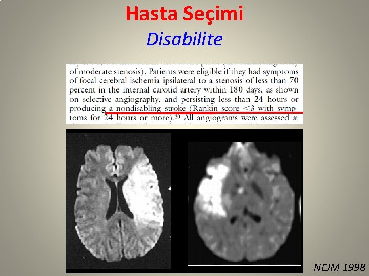 Hasta Seçimi Disabilite NEJM 1998 