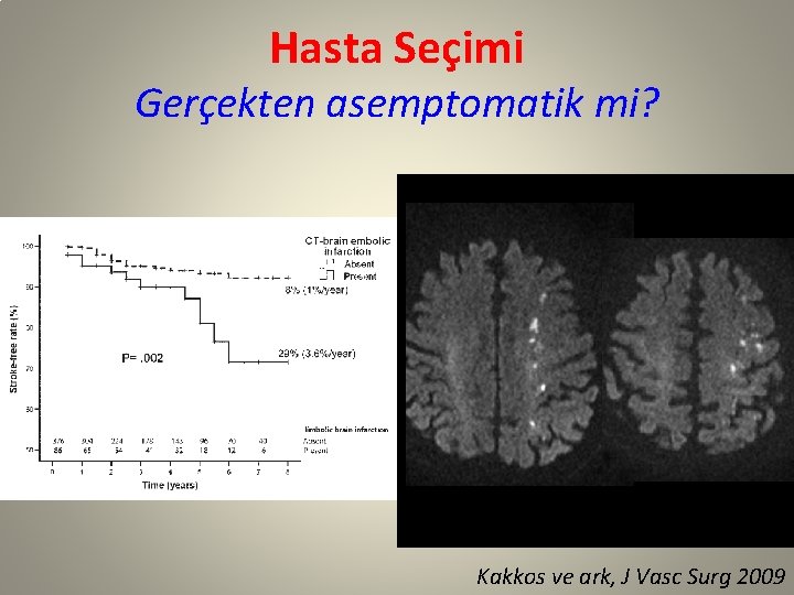 Hasta Seçimi Gerçekten asemptomatik mi? Kakkos ve ark, J Vasc Surg 2009 