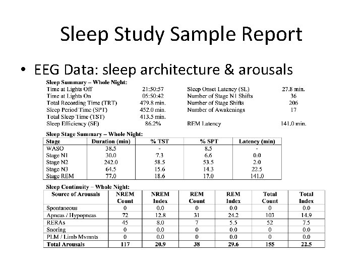 Sleep Study Sample Report • EEG Data: sleep architecture & arousals 