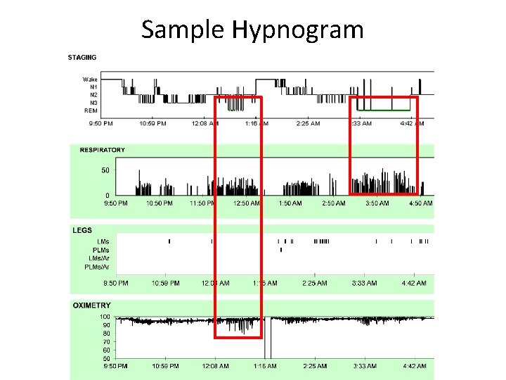 Sample Hypnogram 