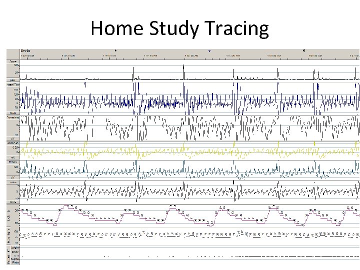 Home Study Tracing 