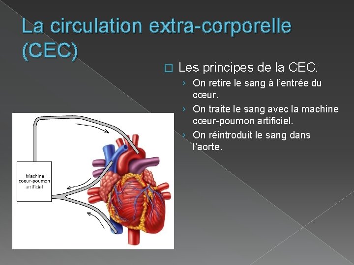 La circulation extra-corporelle (CEC) � Les principes de la CEC. › On retire le
