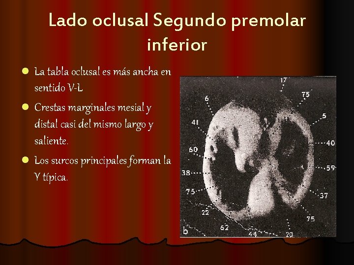 Lado oclusal Segundo premolar inferior l La tabla oclusal es más ancha en sentido