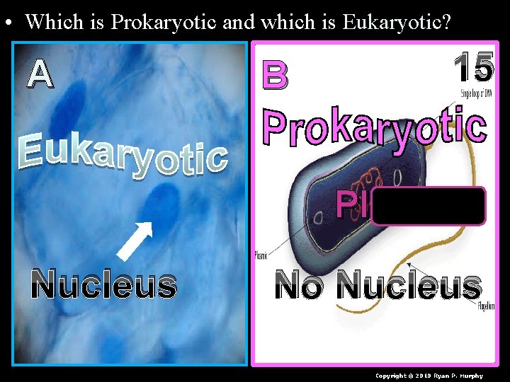  • Which is Prokaryotic and which is Eukaryotic? A B 15 Plasmid Nucleus