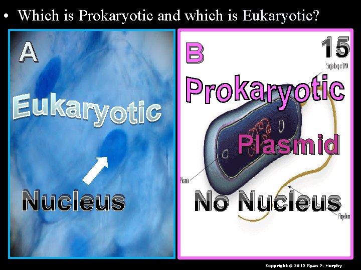  • Which is Prokaryotic and which is Eukaryotic? A B 15 Plasmid Nucleus