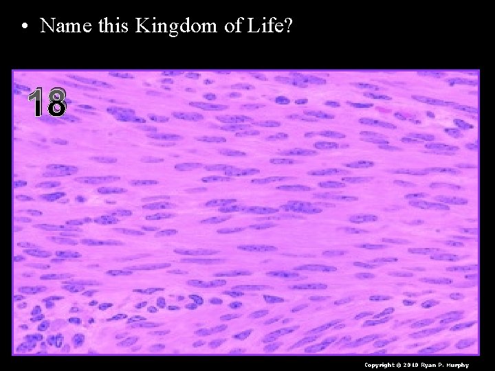  • Name this Kingdom of Life? – I don’t have a cell wall