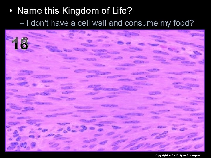  • Name this Kingdom of Life? – I don’t have a cell wall
