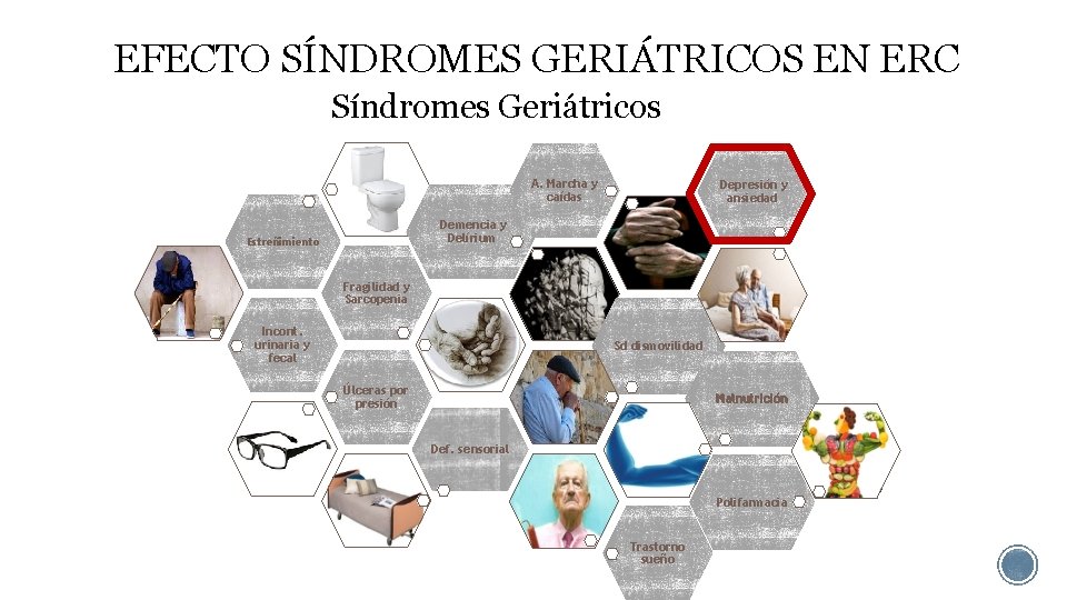 EFECTO SÍNDROMES GERIÁTRICOS EN ERC Síndromes Geriátricos A. Marcha y caídas Depresión y ansiedad