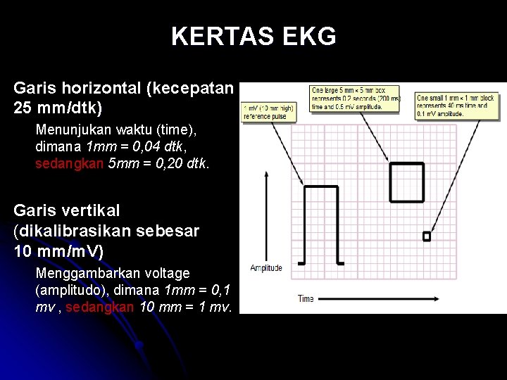 KERTAS EKG Garis horizontal (kecepatan 25 mm/dtk) Menunjukan waktu (time), dimana 1 mm =