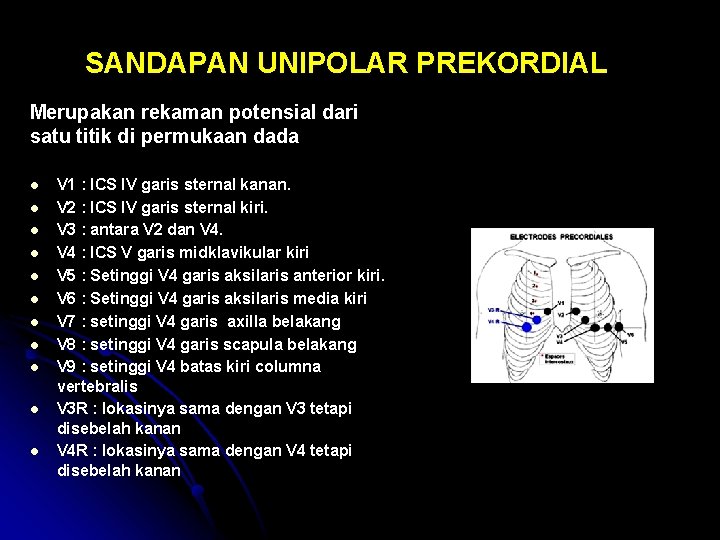 SANDAPAN UNIPOLAR PREKORDIAL Merupakan rekaman potensial dari satu titik di permukaan dada l l