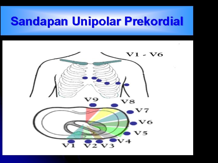 Sandapan Unipolar Prekordial 