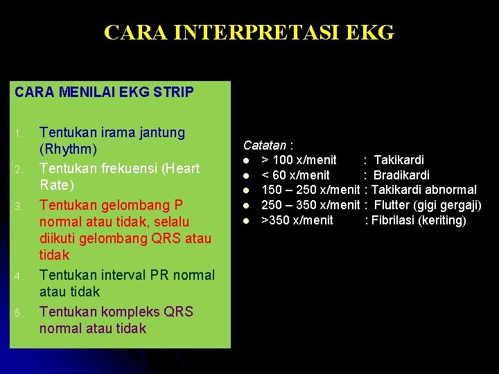 CARA INTERPRETASI EKG CARA MENILAI EKG STRIP 1. 2. 3. 4. 5. Tentukan irama